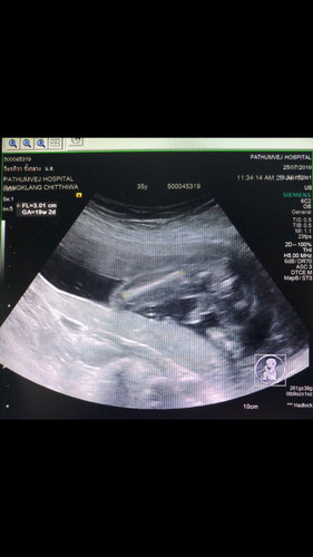 สอบถามค่ะ