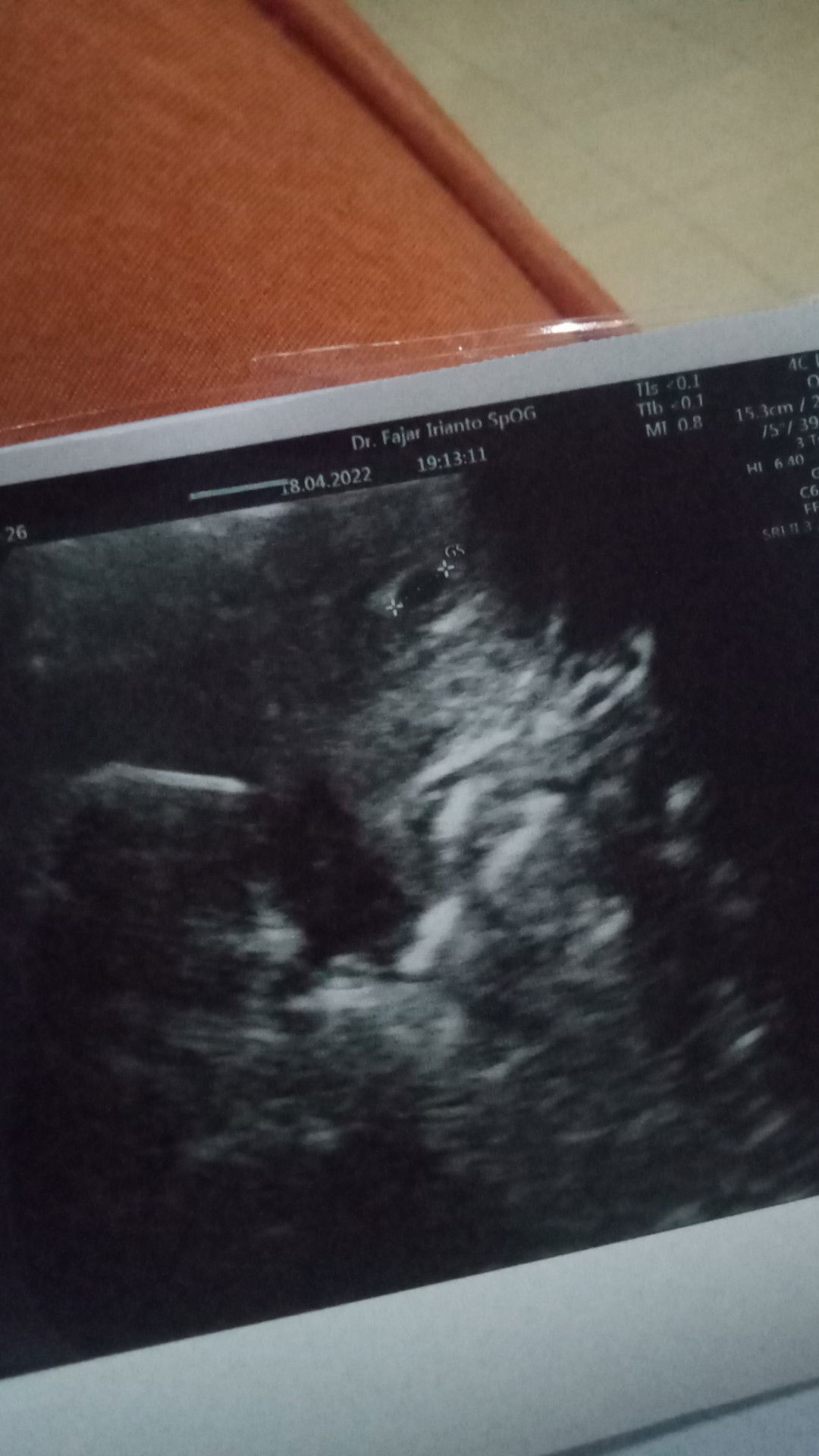 Annisa anggun nirwana profile icon