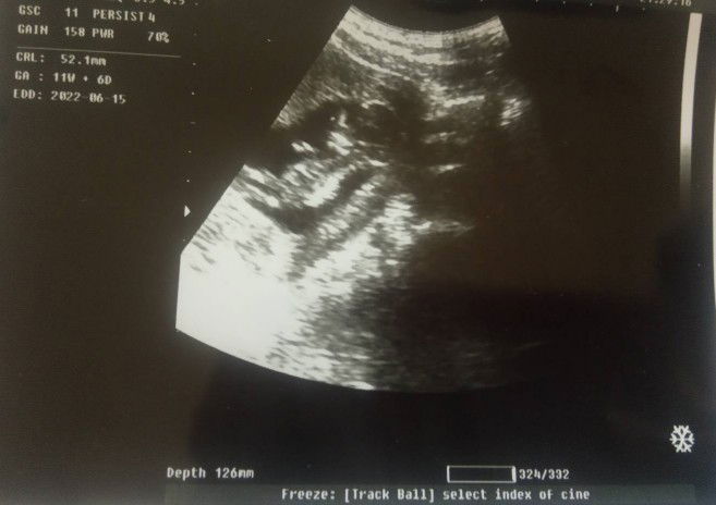 Fey Armala profile icon