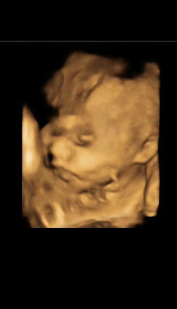 Dwi Setywati profile icon