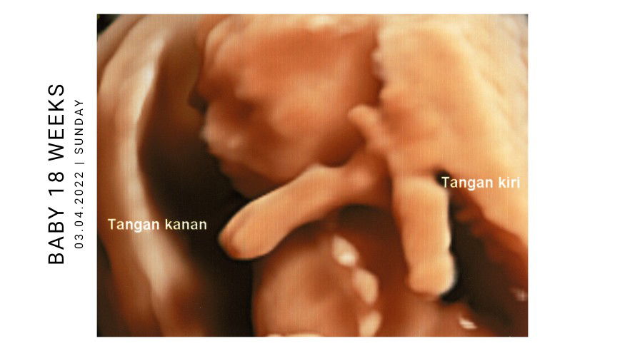 Neli Narulita profile icon