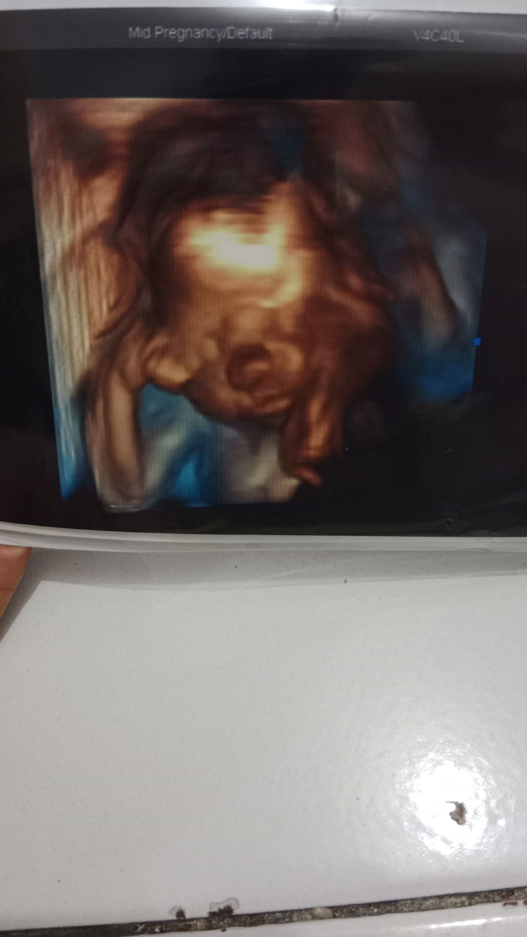 windy tirany profile icon