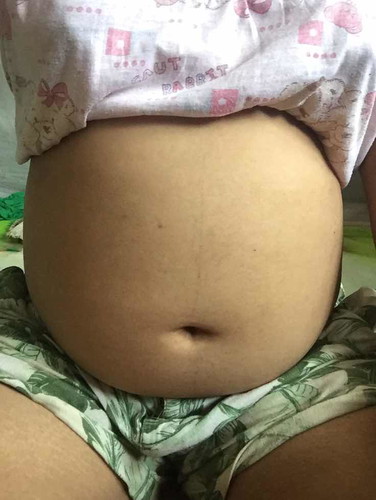 อยากทราบเพศ