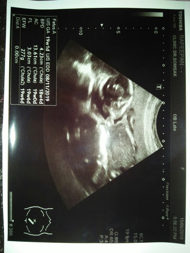 ตั้งครรภ์