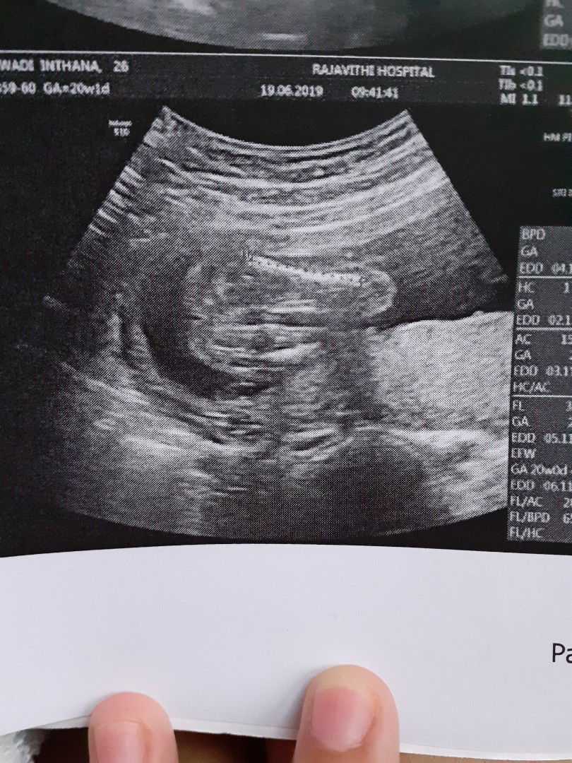 คุณแม่ว่าได้ผู้หญิงหรือชายค่ะ