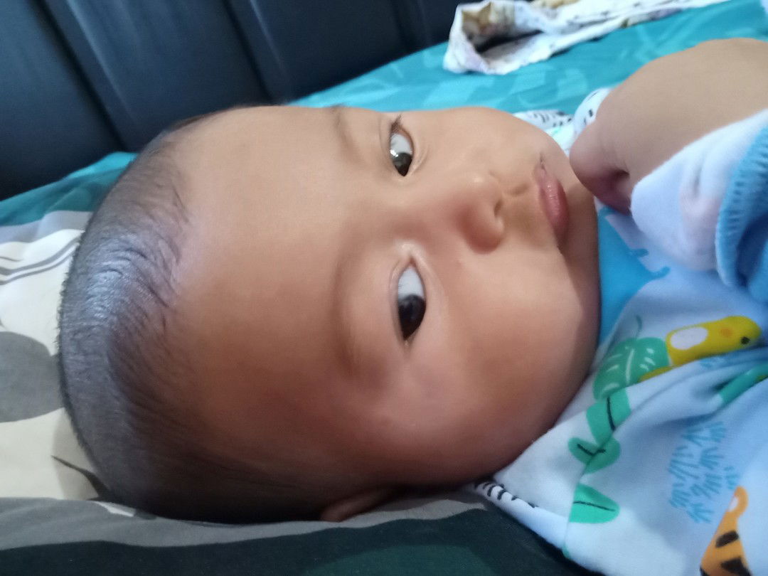 kulit belang kelupas