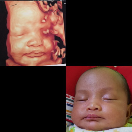 hasil usg dan dunia nyata