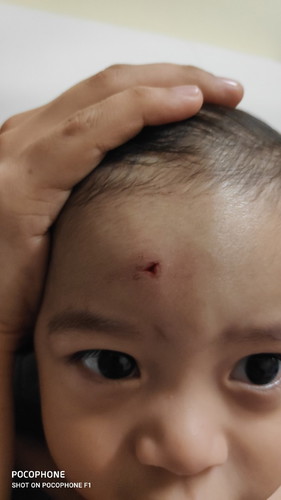 Bayi jatuh katil