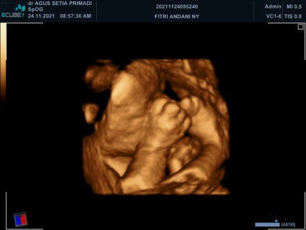 windi cantika rahayu profile icon