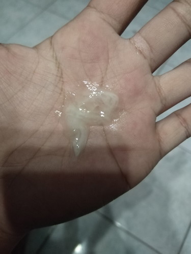 สอบถามแม่ๆคะ ว่าใช่มูกหรือป่าวคะ