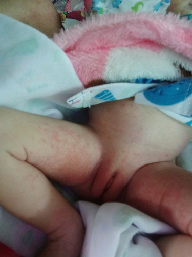 ลูก 12 วัน.
