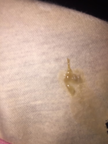 Discharge during 36weeks and 4days