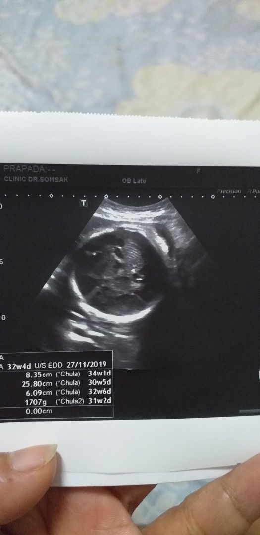 ผลอันตราซาวร์