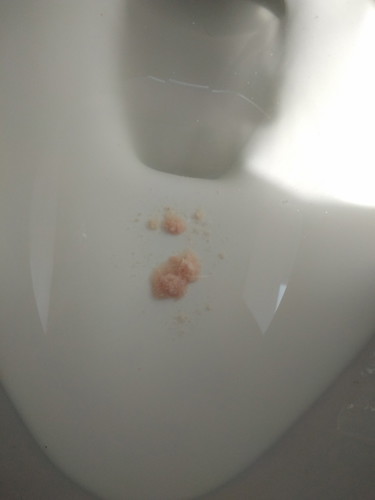 ใครรู้บอกทีค่ะ