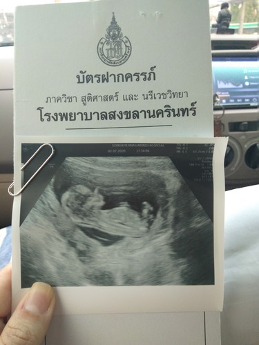 เจ้าตัวเล็ก13วีค