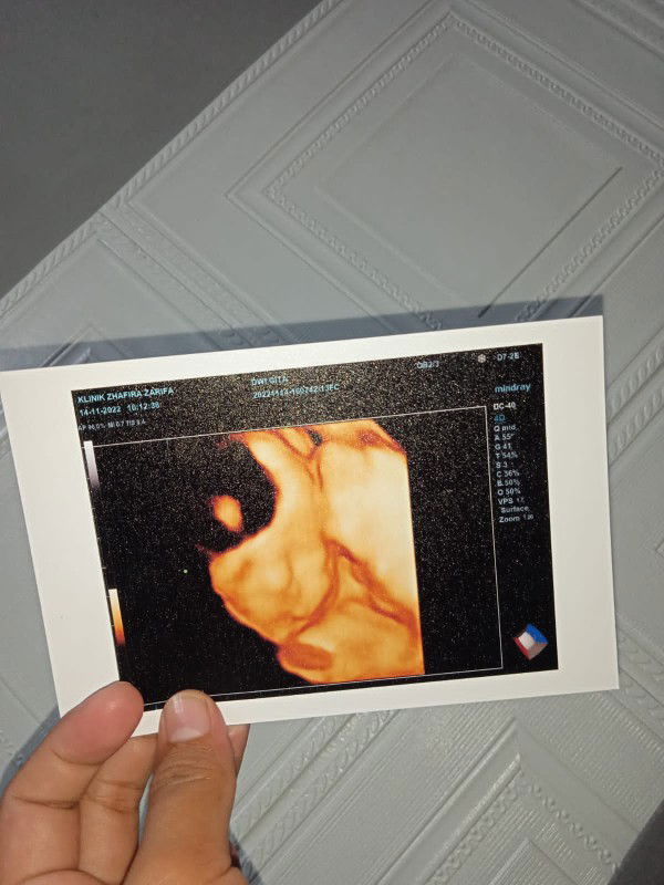 Dwi Gita melinda profile icon