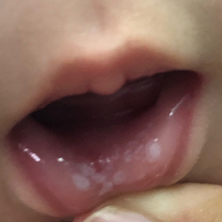 สอบถามคะแม่ๆ