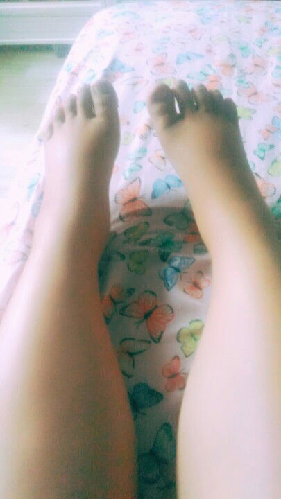 kaki bengkak,, jdi susah sholat.