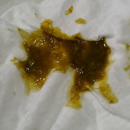 Normal lang ba yung ganitong poop sa pbf?