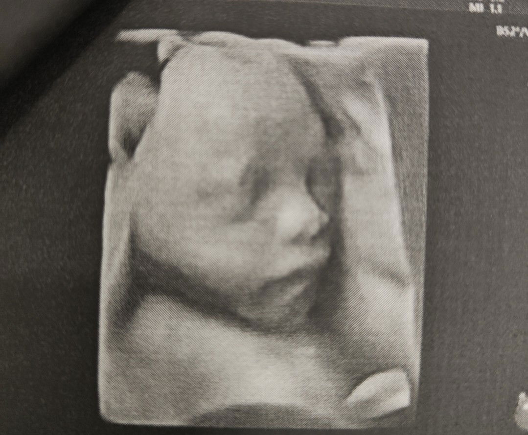 Thitiworada profile icon