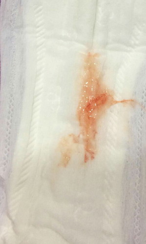 แม่ๆ เเพ้ท้องเลื่อนผ่านไปด่วนๆจ้า