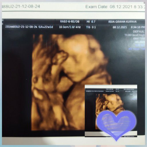 Amina Wati profile icon