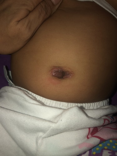 Navel