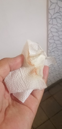 Brown discharge