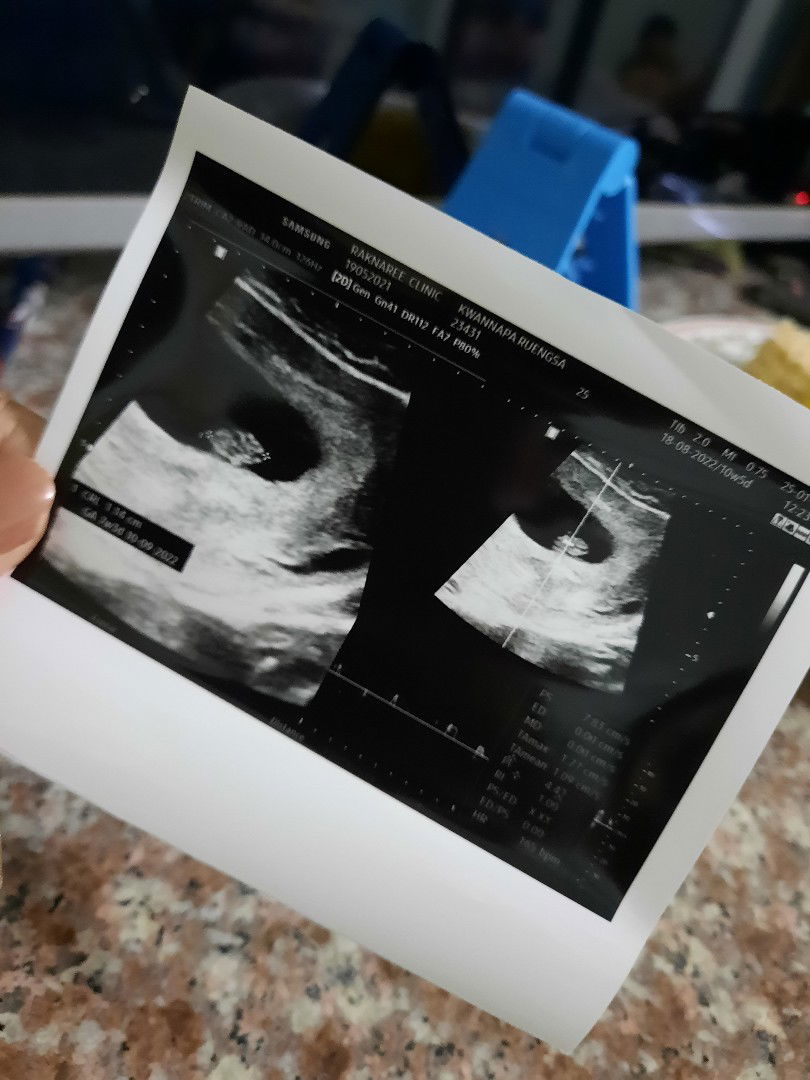 ขวัญนภา profile icon