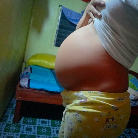 Tummy