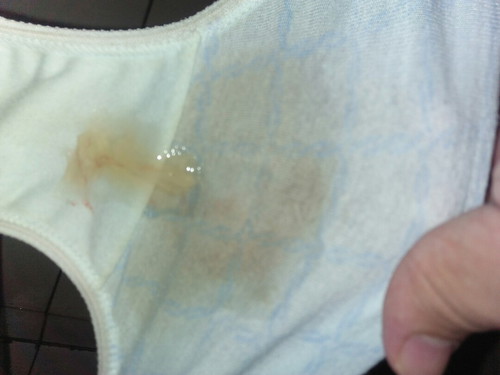 mucus plug?