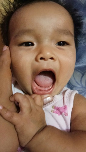 ฟัน