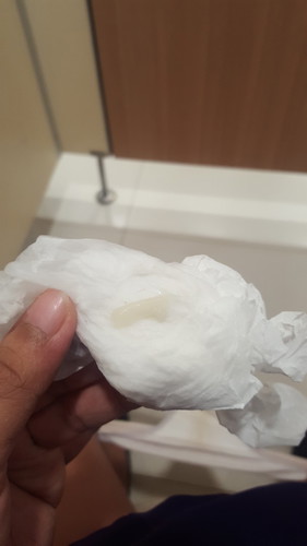 มีอะไรไม่รุ้ออกมา 36w6d แบบนี้คืออะไรค่ะ