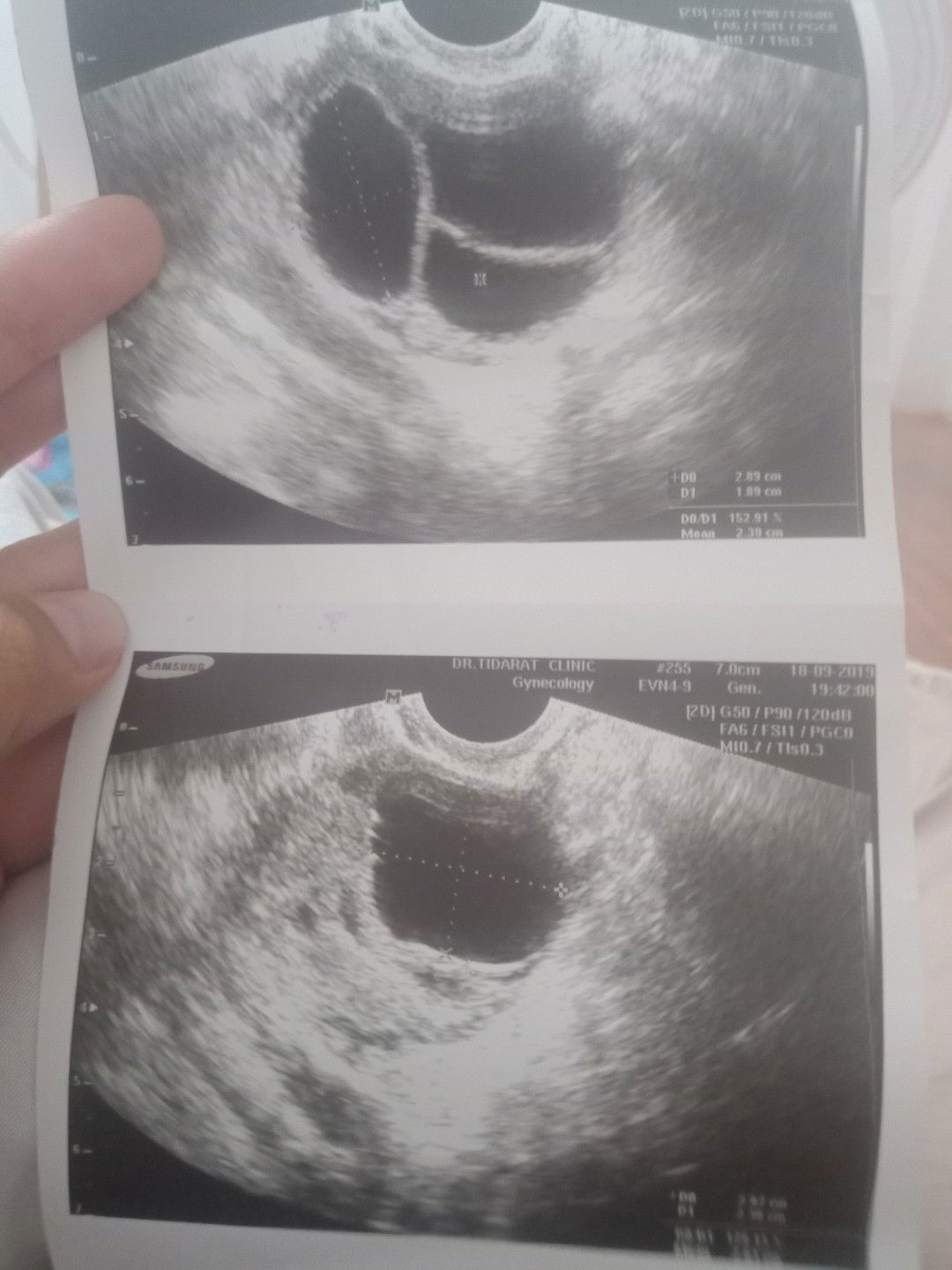 วางแผนมีลูก