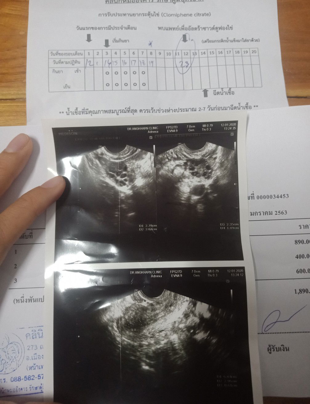 วางแผนมีลูก