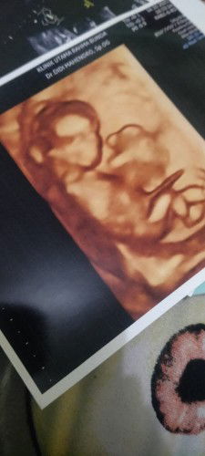 Eka Putri widi hastuti profile icon