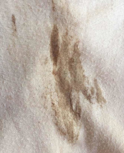 คราบสีน้ำตาล