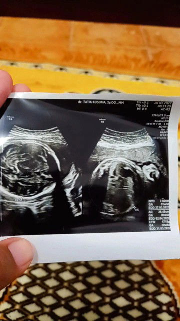 Qomariyah Agustini profile icon