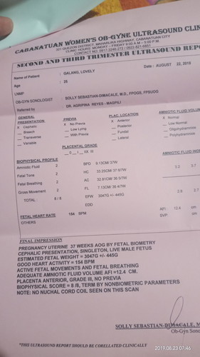 BPS