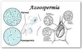 AZOOSPERMIA