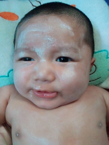 เด็กจ้ำม่ำ?