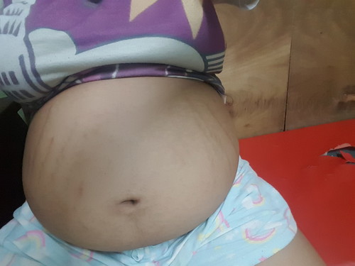 tummy for 28 weeks