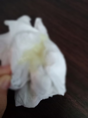 มีมูกสีขาวขุ่นออกมาจากช่องคลอด แต่ไม่มีอาการปวดท้องคะตอนนี้38+คะ