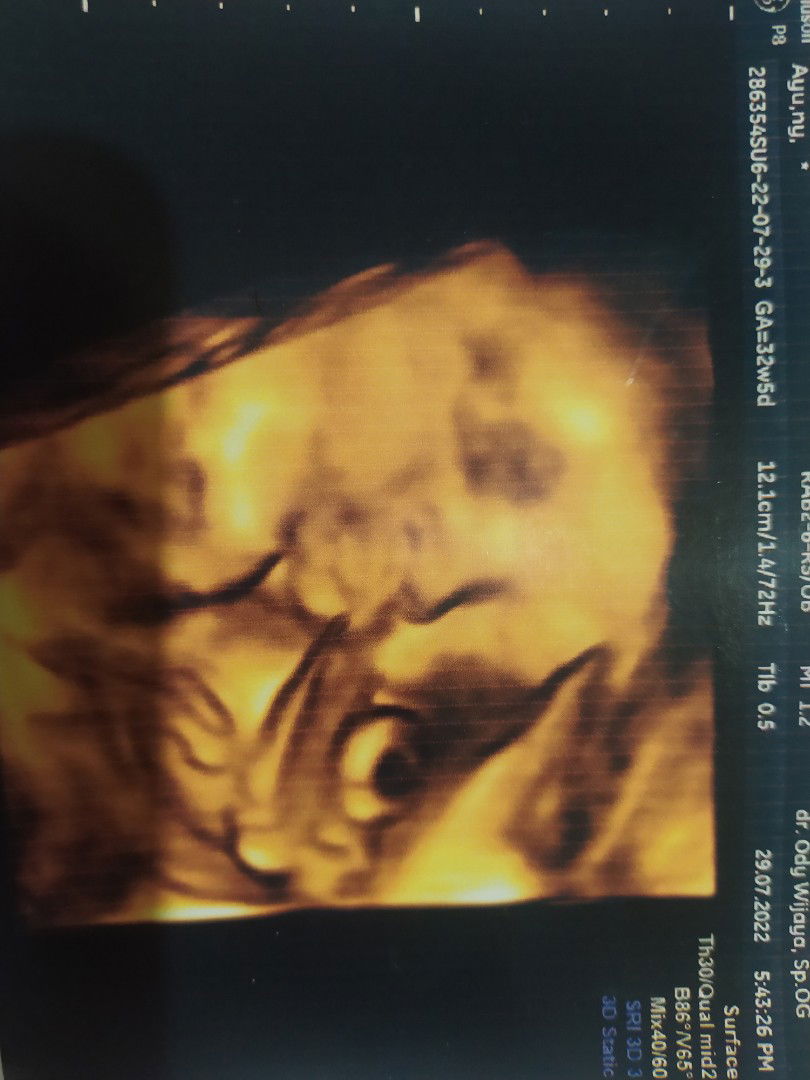 Ayu Novita profile icon