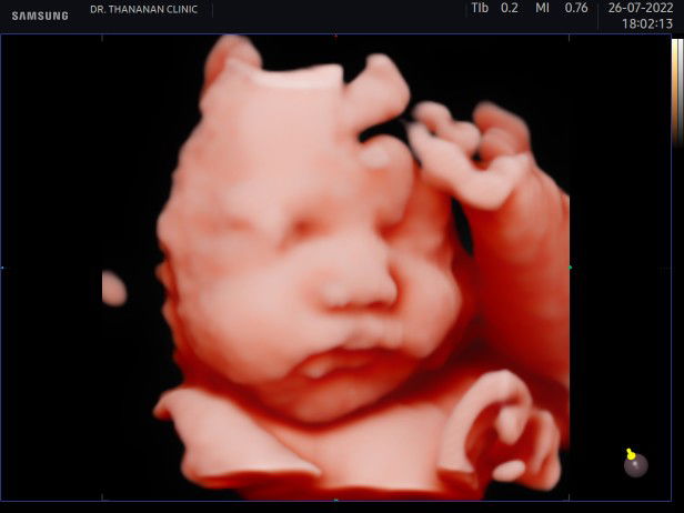 พัชรา มาทอง profile icon