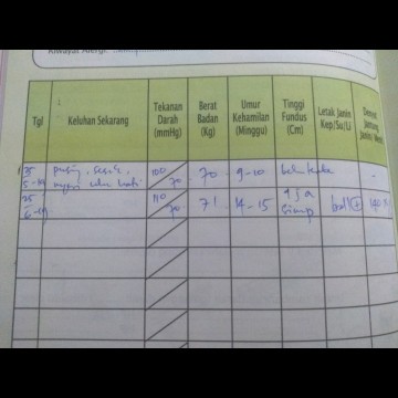 JANIN TERABA OLEH BIDAN