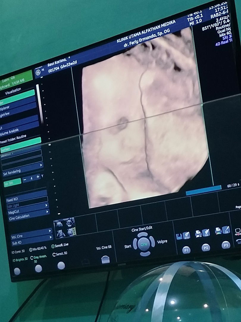 Revi carlina profile icon