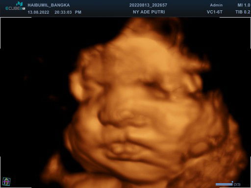 Ade Putri Febriana profile icon