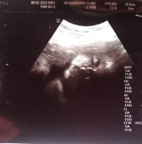 ปลาย' ด้อแด้ profile icon