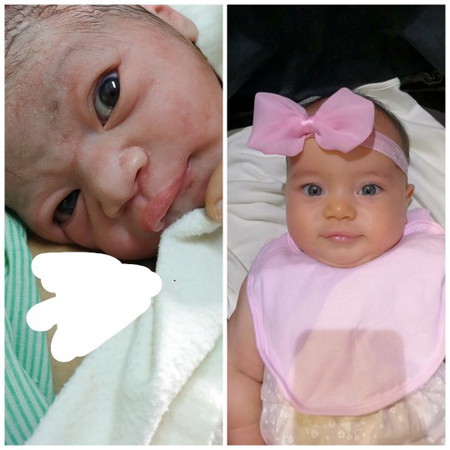 Baby's Transformation